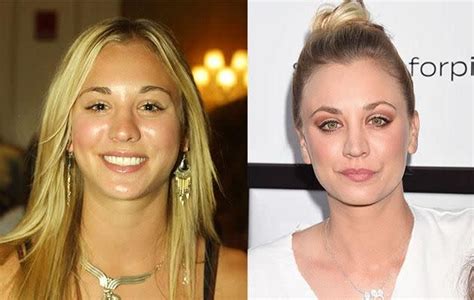 Kaley Cuoco Reveals She Had Boob and Nose Jobs